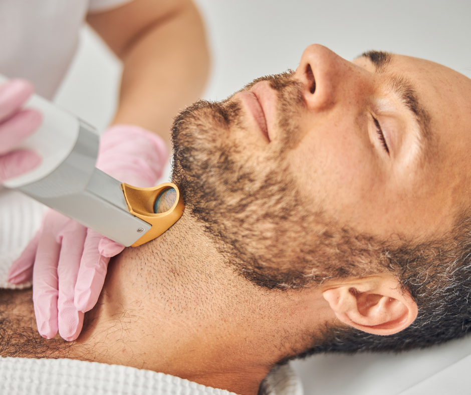 Homme recevant une séance d’épilation laser de la barbe et du collier réalisée par un professionnel