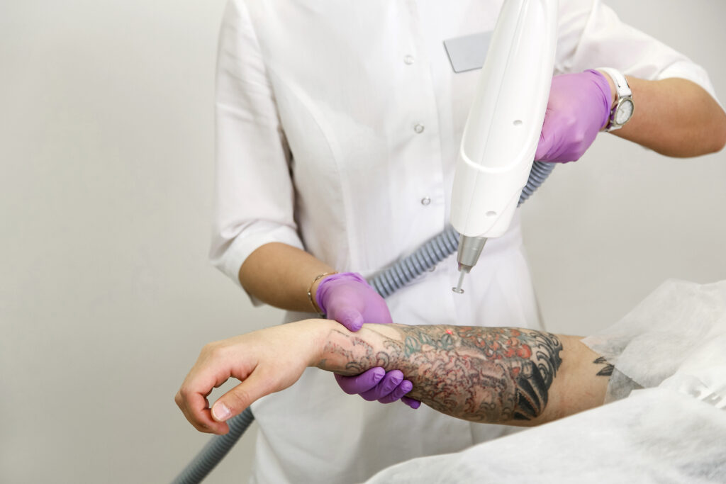 Praticienne réalisant une séance de détatouage laser sur l’avant-bras tatoué d’un patient à Paris au centre CCM Medical Training